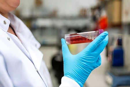 Virus onerariam Ornamentum (non-inactivated) - Tutus Virus Sample Collection