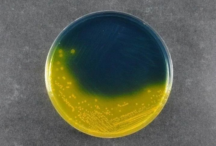 CASSITUS Cibus Salutis: Babio scriptor Salmonella Shigella Agar (SS) Sustils Global Pathogen deprehensio Signa