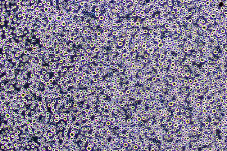 Capsicum annuum dextrose Agar (USP) - Reliable Medium Fingunt et fermento deprehendatur