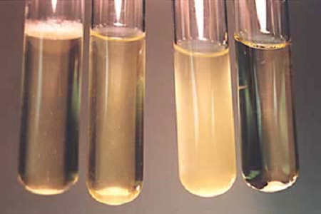 Babio Launches summus euismod cerebri Cordis Infusionem Ius pro Global Microbiologia Labs