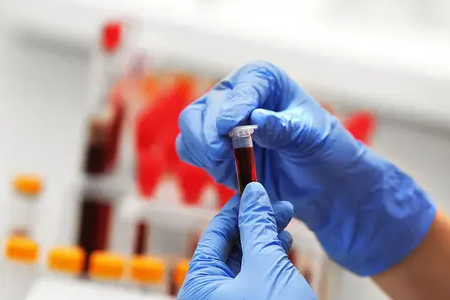 BABIO Launches Fluorescens Bovine Graviditas Celeri Test