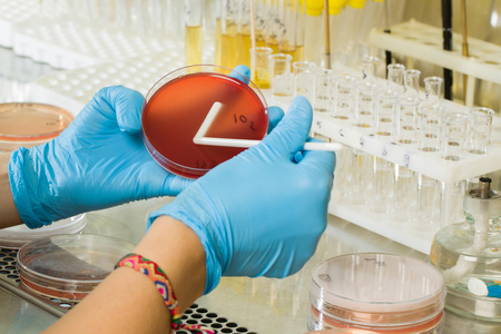 BABIO MacConkey Agar Medium – Premium Selective Isolation for Global Microbiological Diagnostics