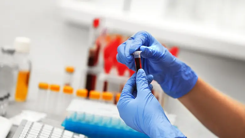 BABIO H. pylori Antigen Test Ornamentum Rapid Test Kit pro Fast Gastrointestinal Screening Introduces
